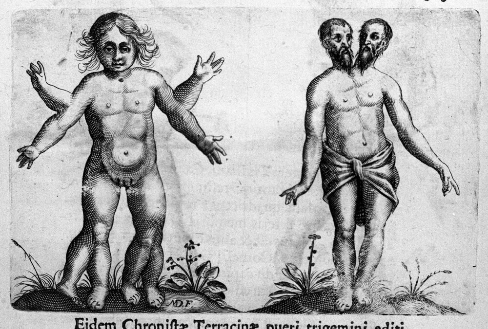 Olika typer av mänskliga monster Gravyr från "Monstrens natur, deras orsaker och skillnader" av Fortunio Whilei (1577-1656), italiensk vetenskapsman. 1646 av Italian School