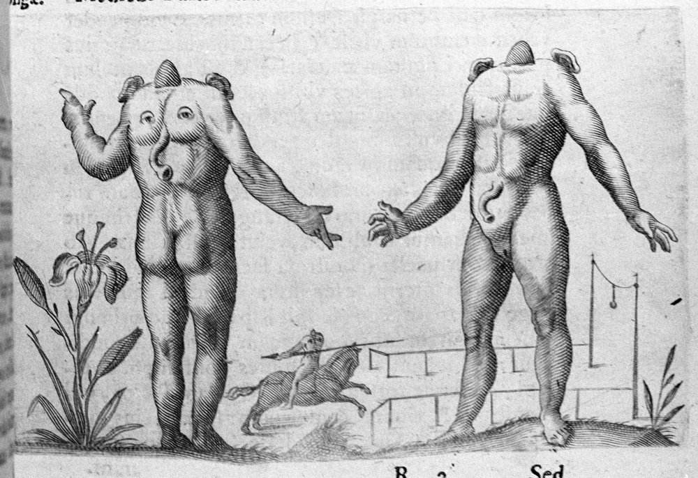 Olika typer av mänskliga monster: en man utan huvud. Gravyr från "Monstrens natur, deras orsaker och skillnader" av Fortunio Whilei (1577-1656), italiensk vetenskapsman. 1646 av Italian School
