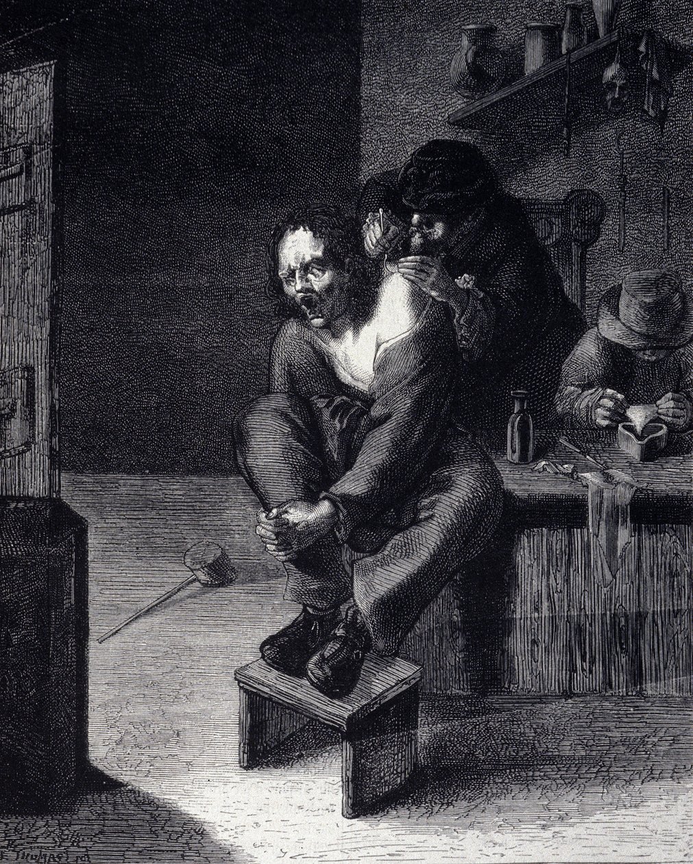 Den kirurgiska operationen Gravyr efter en målning av Adrien Brauwer (gjord 1608) 1600-talet av Adriaen (after) Brouwer