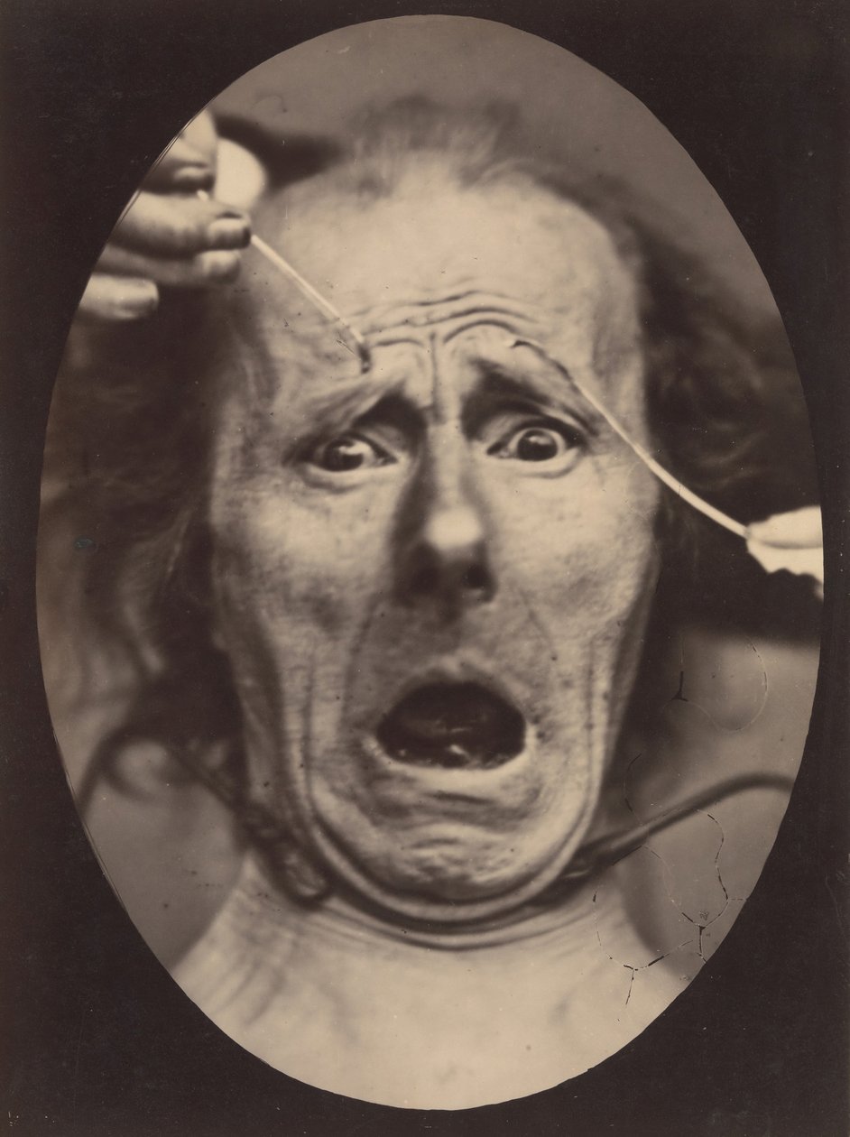 Electro-Physiologie, figur 64, 1854-56, tryckt 1862. av Adrien Alban Tournachon