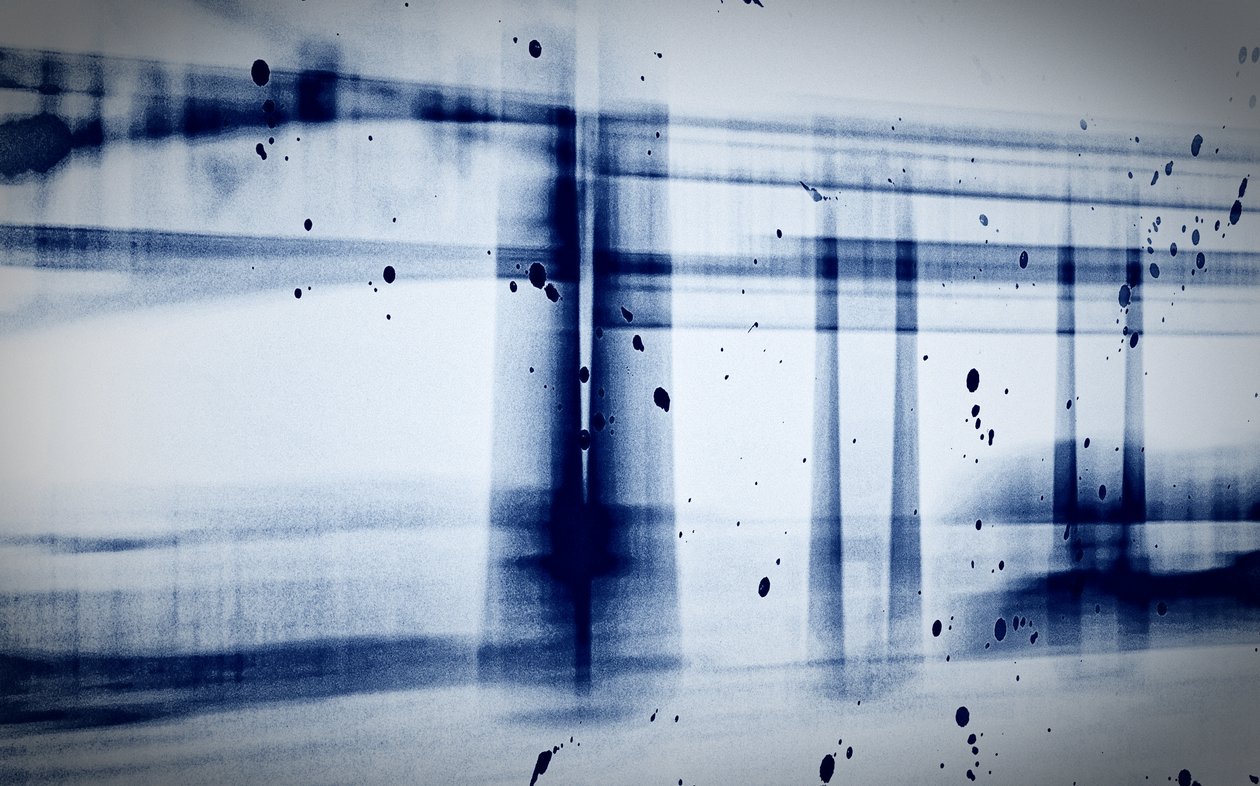 Snö (röntgen), 2019, (fotografi) av Alex Caminker