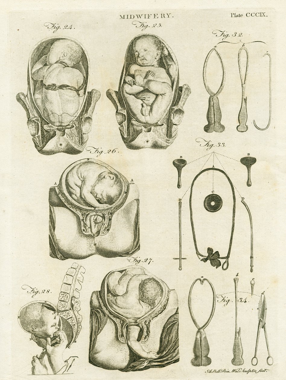 Barnmorska, illustration från 