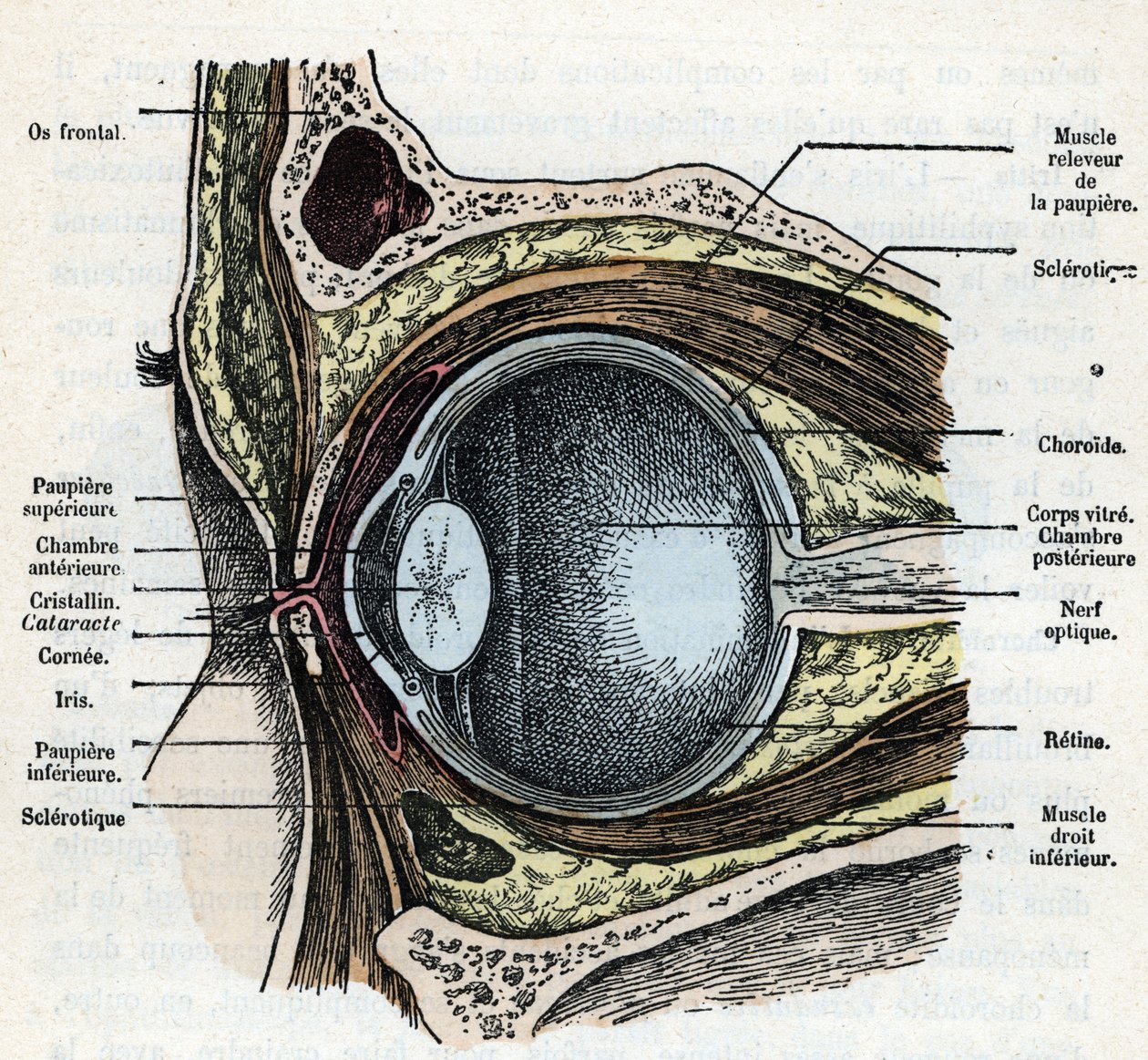 Vertikal skärning av en ögonglob med grå starrgravyr från "Nature and Man" av Rengade 1881 Privat samling av Alphonse Demarle