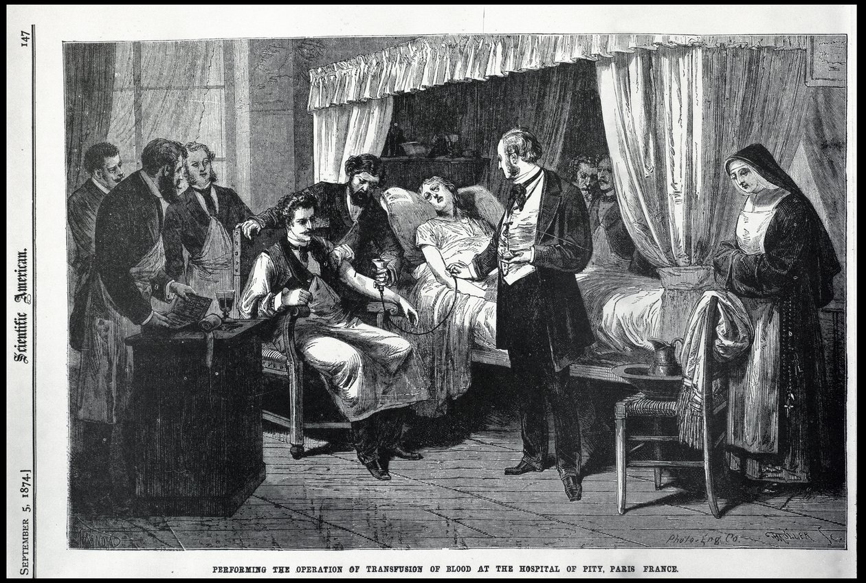 Utför operationen av blodtransfusionen på Hospital of Pity, Paris, Frankrike, illustration från den amerikanska forskaren av American School