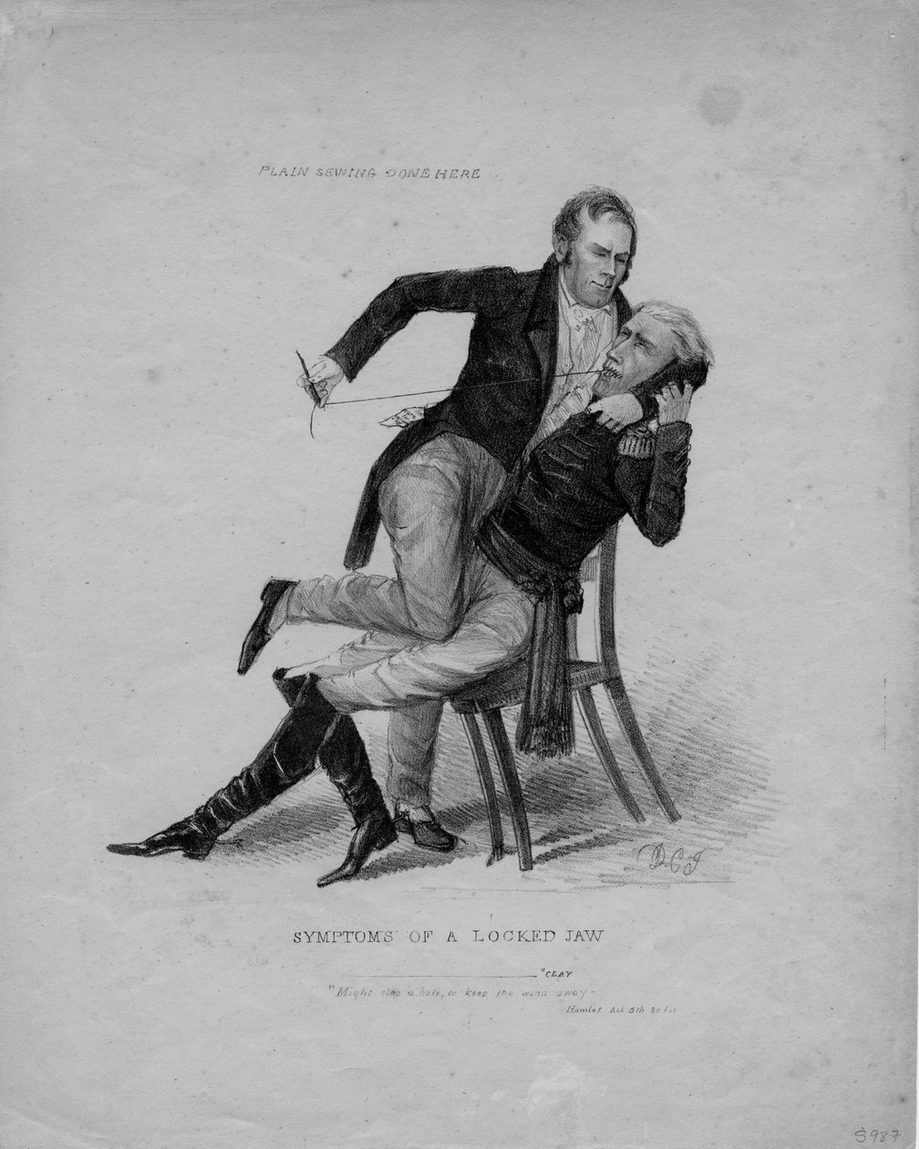 Symtom på en låst käke, ca 1827 av American School