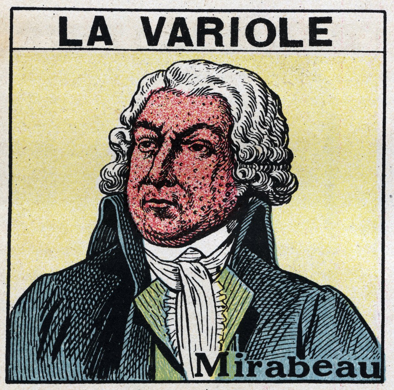 Porträtt av Honore Gabriel (Honore-Gabriel) Riqueti, greve av Mirabeau (1749-1791) med ansiktet av en figur av smittkoppor. För att undvika ärr orsakade av smittkoppor bör patienterna behandlas i rum eller endast gå in i rött ljus, fritt från ultravioletta av Anonymous Anonymous