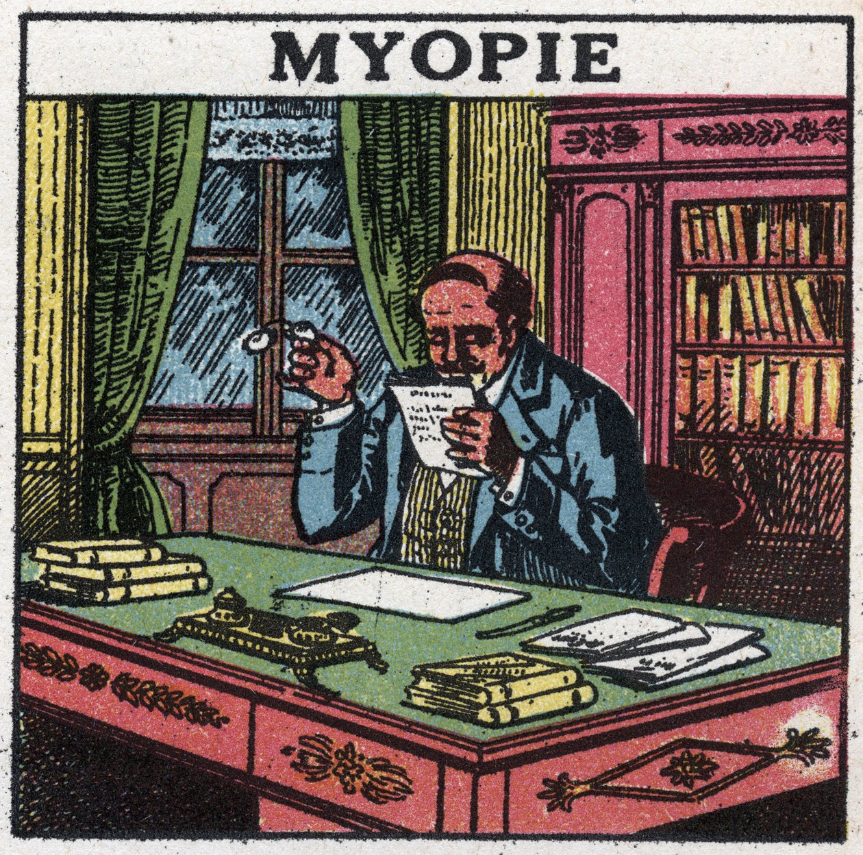 Ögat: person som lider av närsynthet. Anonym illustration från 1925. Privat samling. av Anonymous Anonymous