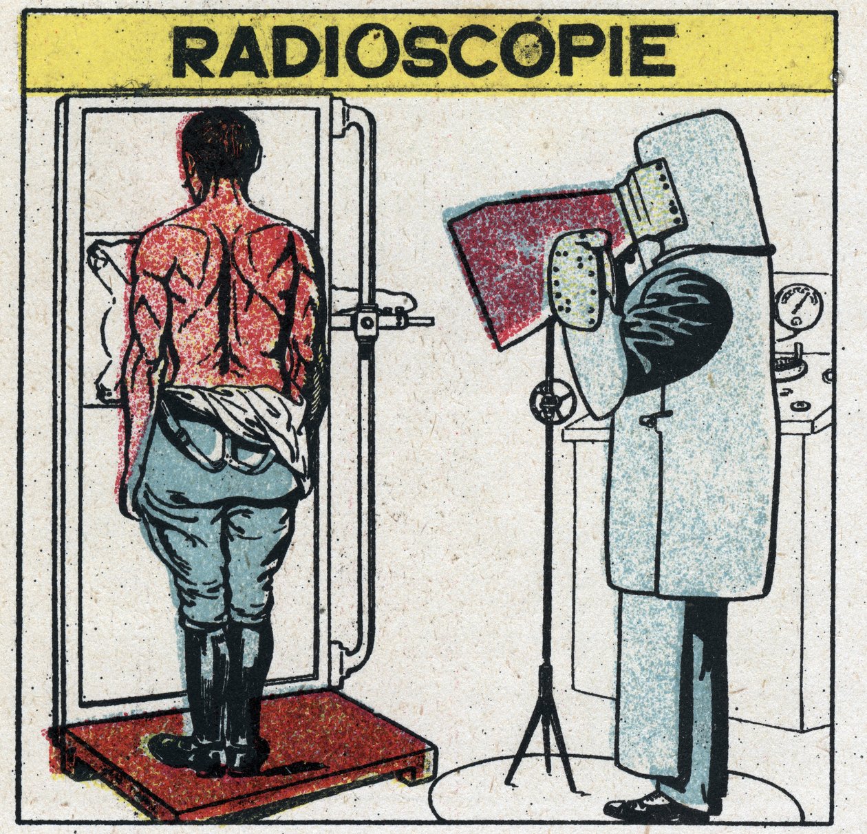 Röntgen: radioskopi av en människokropp. Radiologen skyddar sig mot röntgenstrålning genom att bära en gummiduk med en gummiupplösning innehållande blysalter, hans huvud är täckt med en mössa och hans händer med handskar av samma tyg, hans ögon är pr. av Anonymous Anonymous