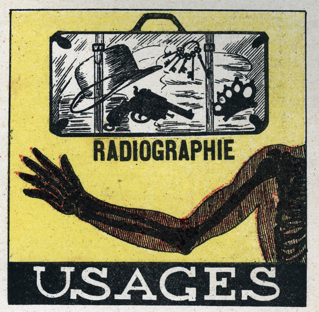 Röntgen: användning av röntgen för att se igenom föremål och kroppar. Anonym illustration från 1925. Privat samling. av Anonymous Anonymous