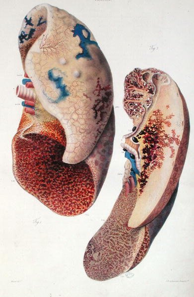 Pneumoni, från 