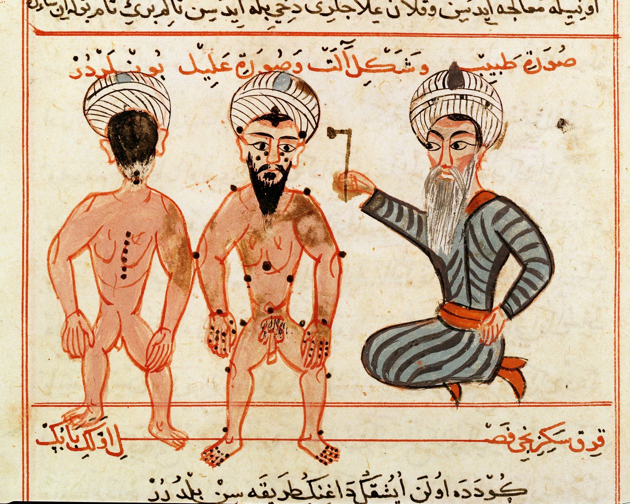 Ms Sup Turc 693 fol.46v Bränning av spetälska skador, 1466 av Charaf ed Din