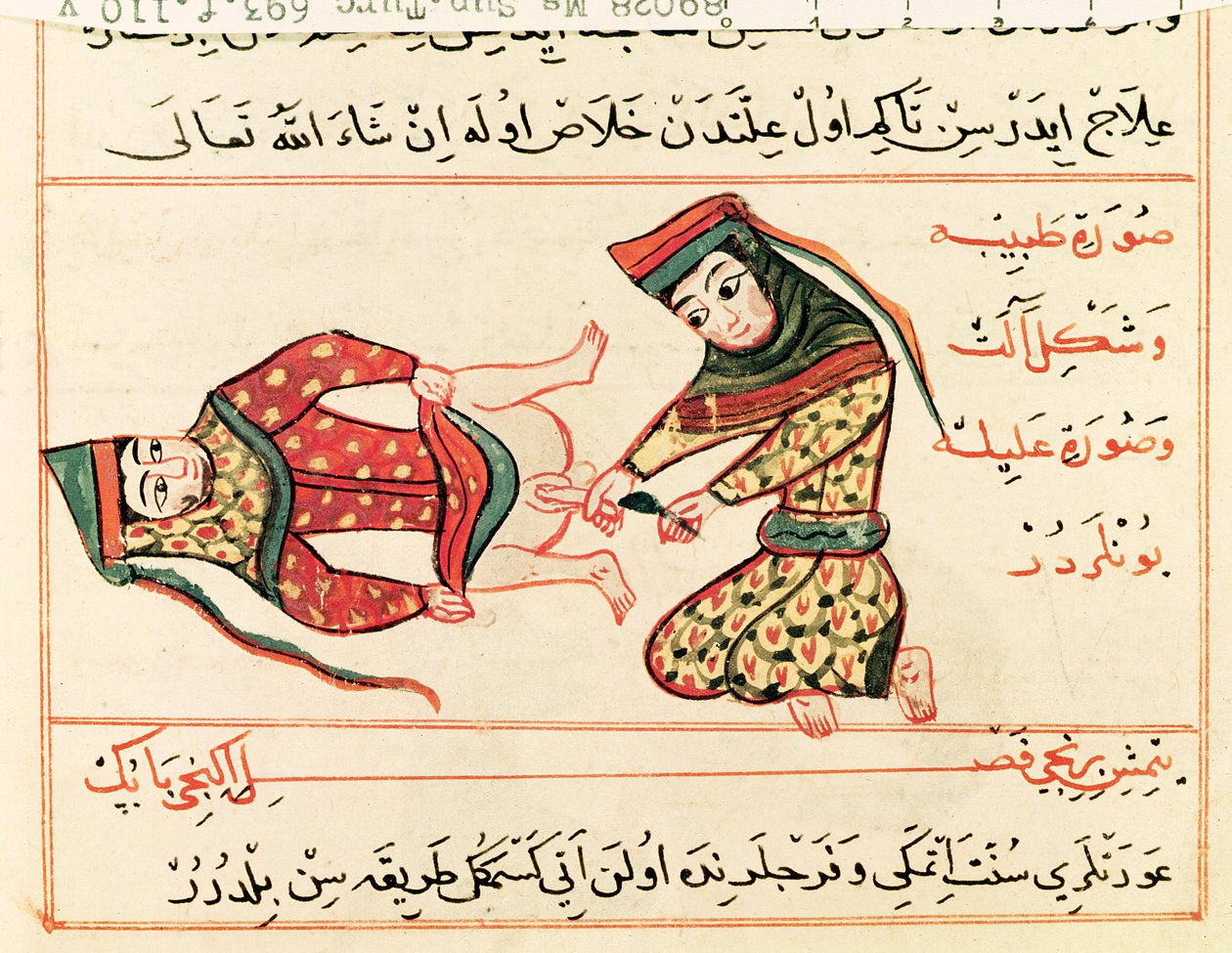 Ms Sup Turc 693 fol.110v Barnmorska som opererar en hermafrodit, 1466 av Charaf ed Din