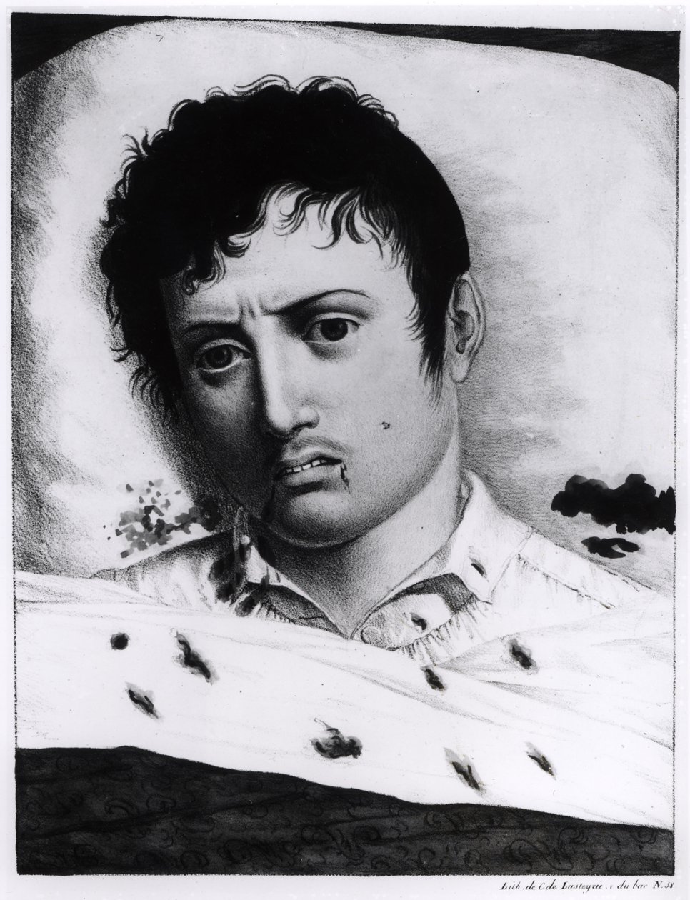 Observation av gula febern, c.1819 av Charles Lasteyrie du Saillant