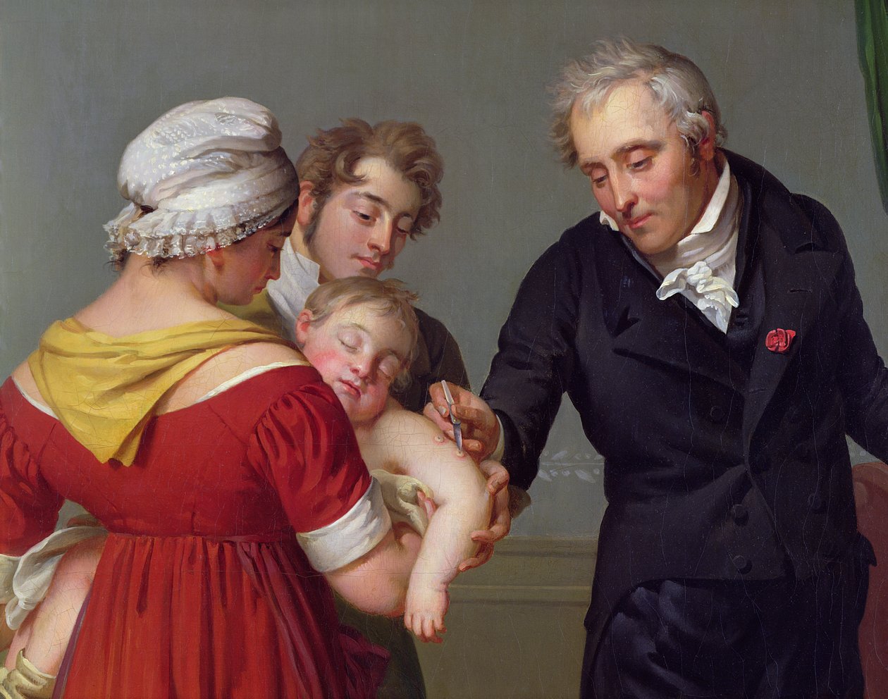 Baron Jean Louis Alibert (1768-1837) vid vaccinering mot smittkoppor i Liancourt-slottet, ca 1820 (detalj). av Constant Joseph Desbordes