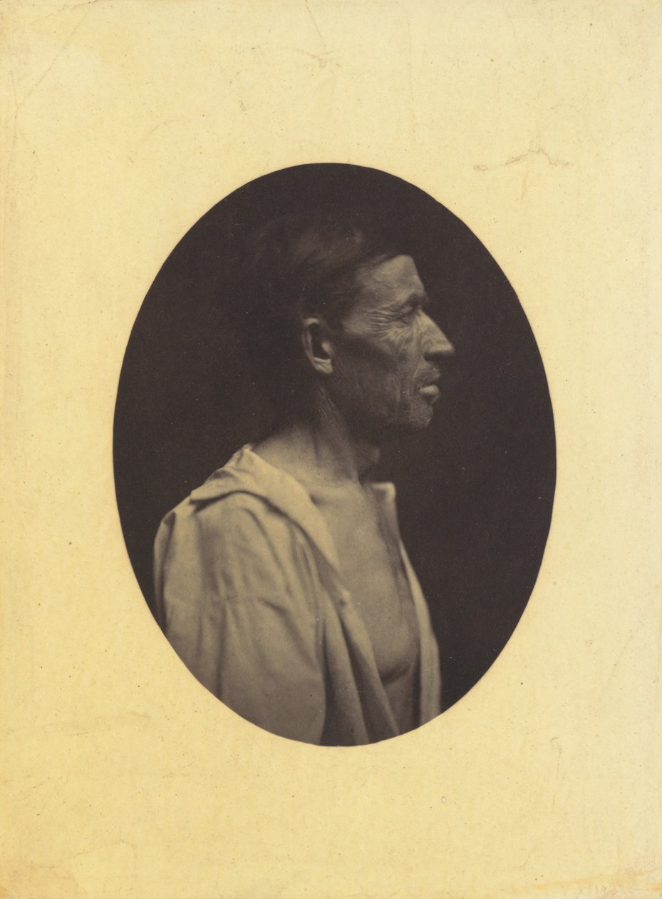 Ett porträtt, sett i profil, av en man 42 år gammal, bedövad av alkoholmissbruk..., 1854-1856. av Duchenne de Boulogne