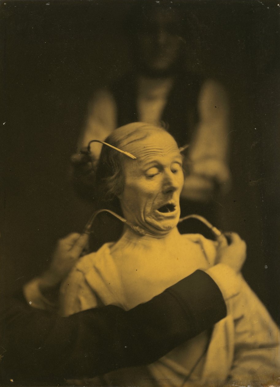 Skräckuttryck, 1854-1856, tryckt 1862. av Duchenne de Boulogne