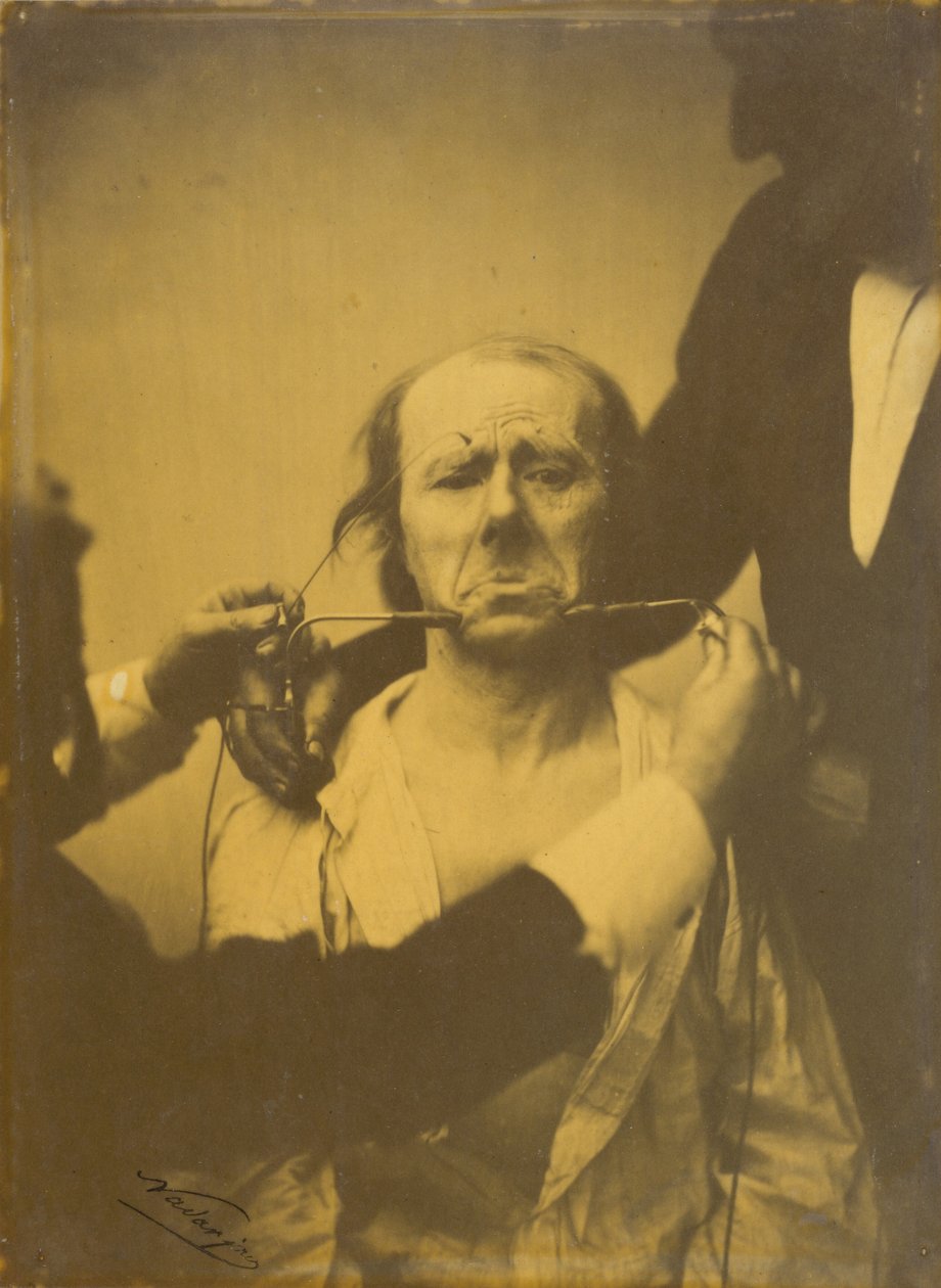 Smärta och förtvivlan, 1854-1856, tryckt 1862. av Duchenne de Boulogne
