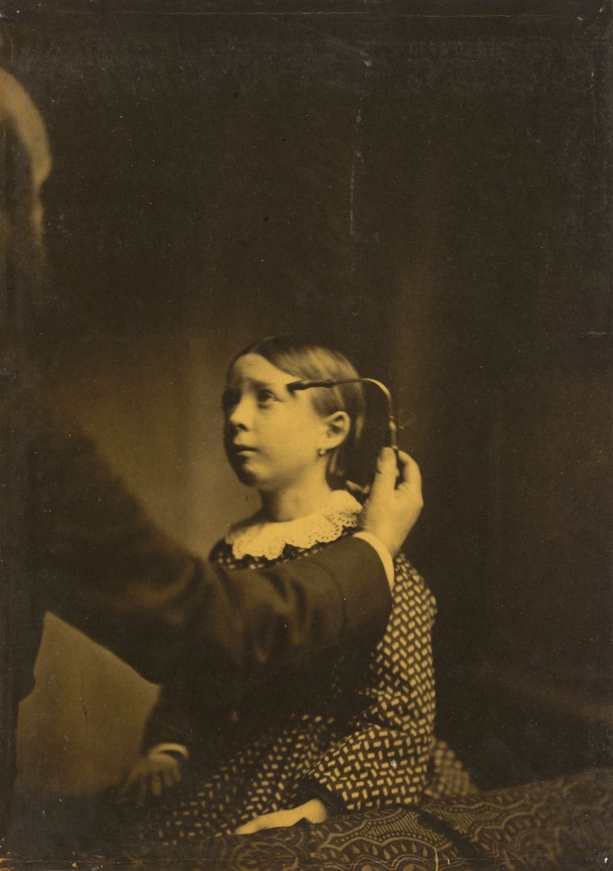 Smärtsamma minnen, 1854-1856, tryckt 1862. av Duchenne de Boulogne