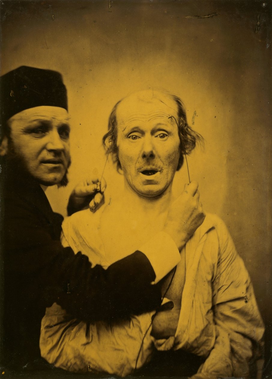 Surprise, 1854-1855, tryckt 1862. av Duchenne de Boulogne