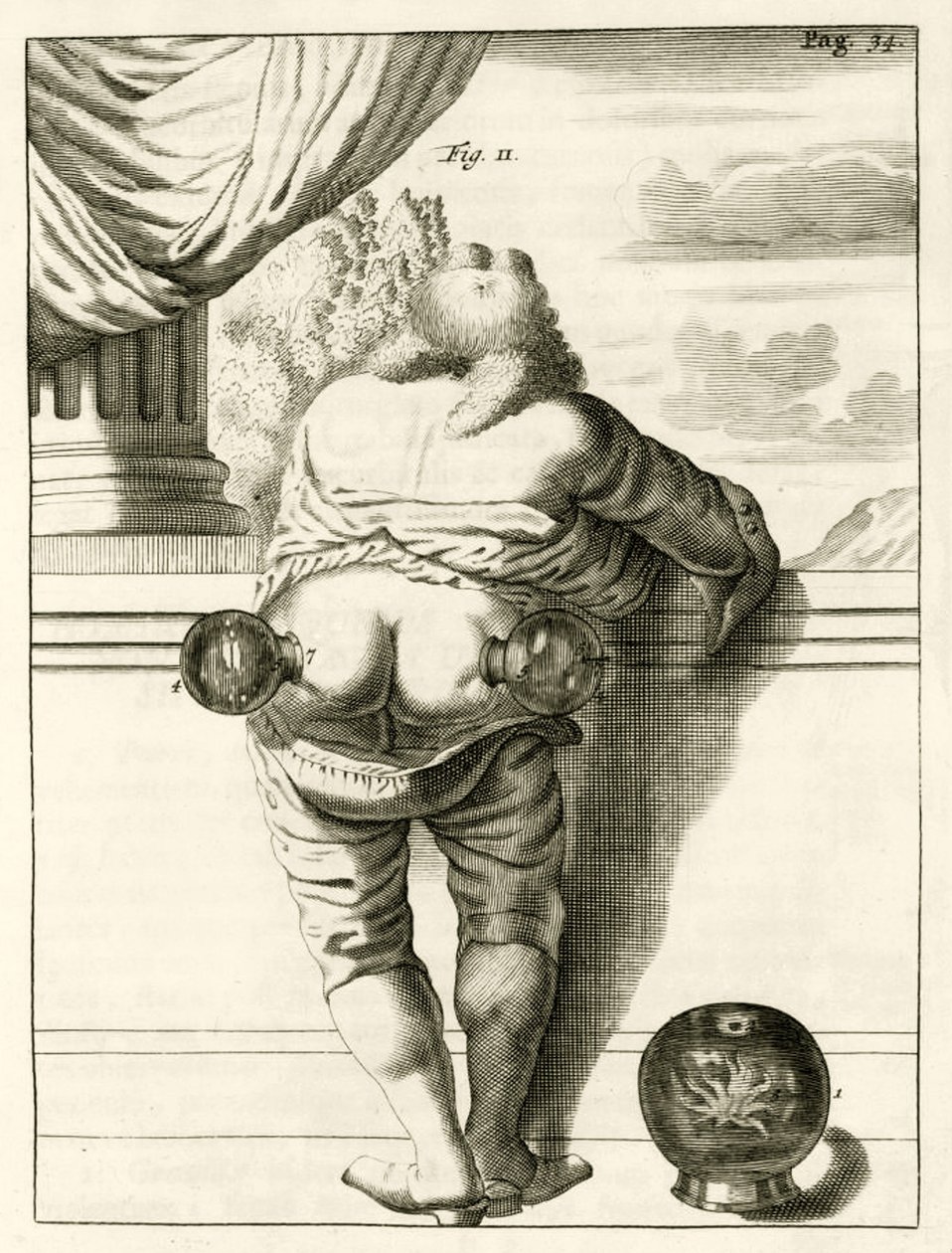 Ett exempel på koppning, från The Practice of Medicine av Frederik Dekkers, 1694 av Dutch School
