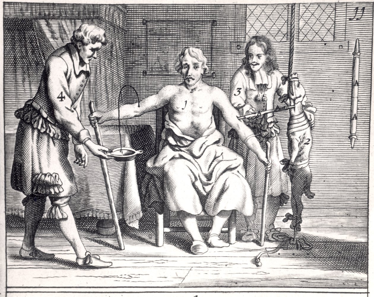 Blodtransfusion från en hund, från Armamentarii Chirurgici av Johannes Schultes (1595-1645) publicerad i Amsterdam, 1671 av Dutch School