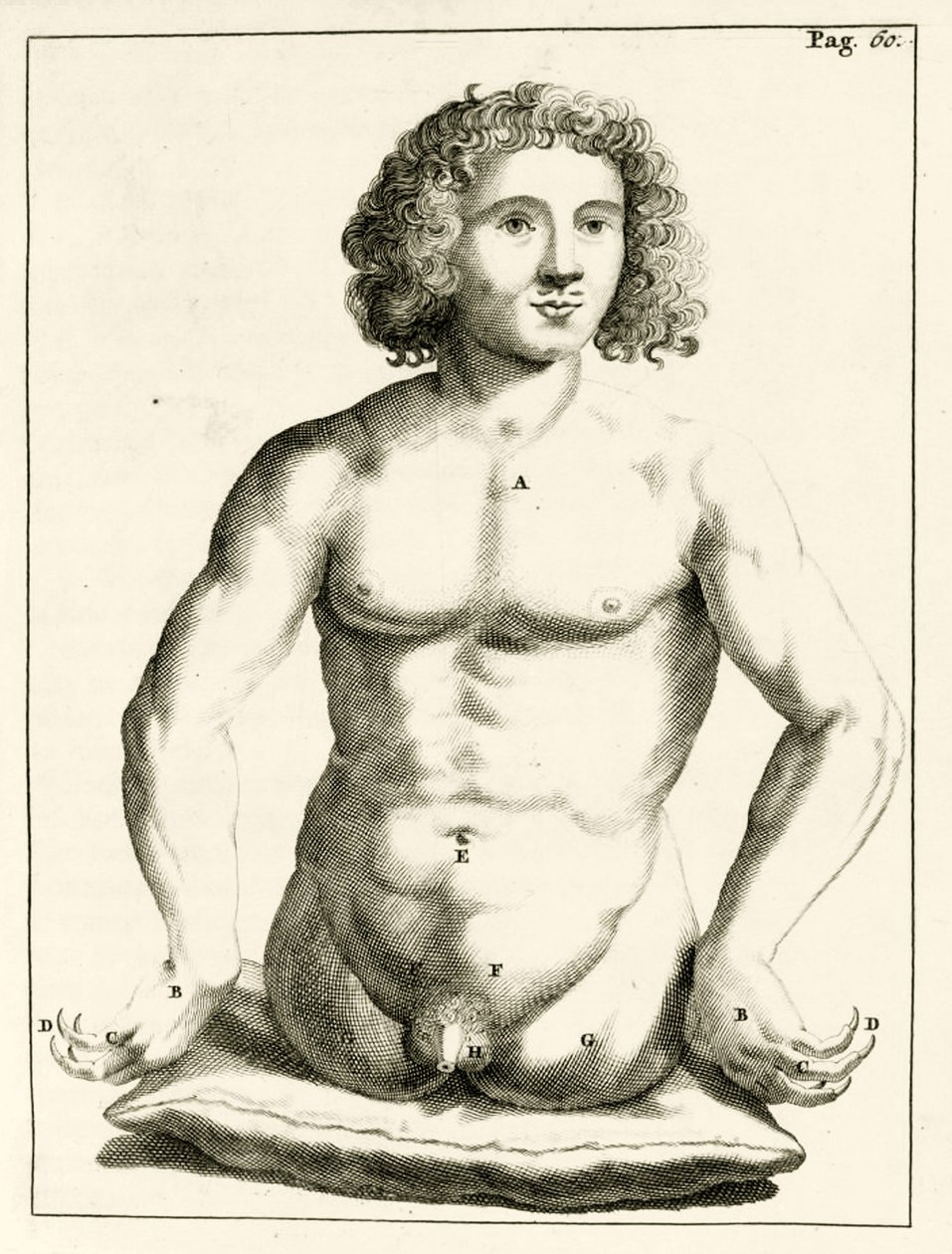 Exempel på medfödda missbildningar av Frederik Dekkers, 1694 av Dutch School