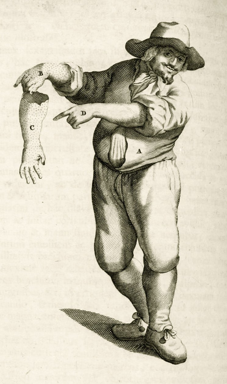 Ta bort död hud med pustler, från Practical Exercises in Medical Methods av Frederik Dekkers, 1694 av Dutch School