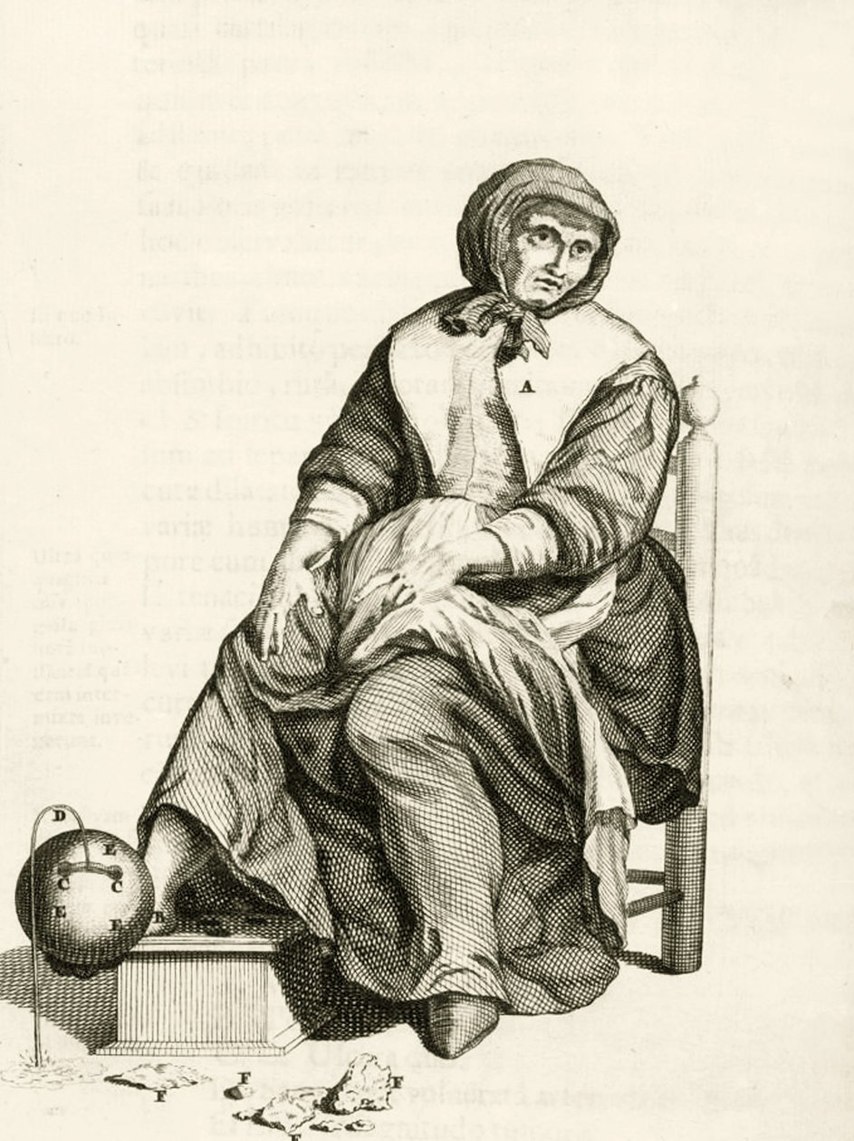Using a Mechanical Leech, från Practical Exercises concerning the Method of Healing av Frederik Dekkers, 1694 av Dutch School