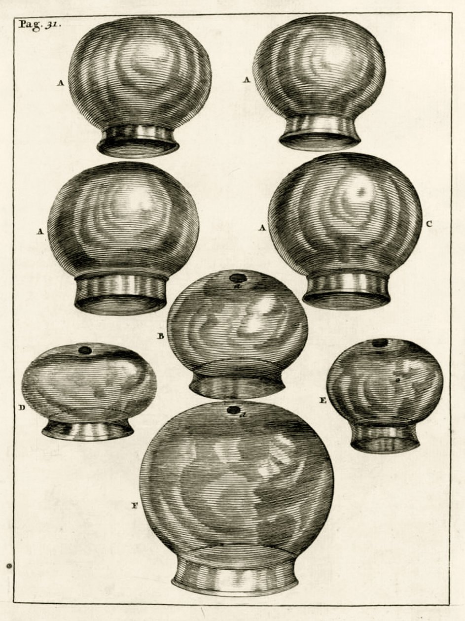 Olika koppningsglas, från The Practice of Medicine av Frederik Dekkers, 1694 av Dutch School
