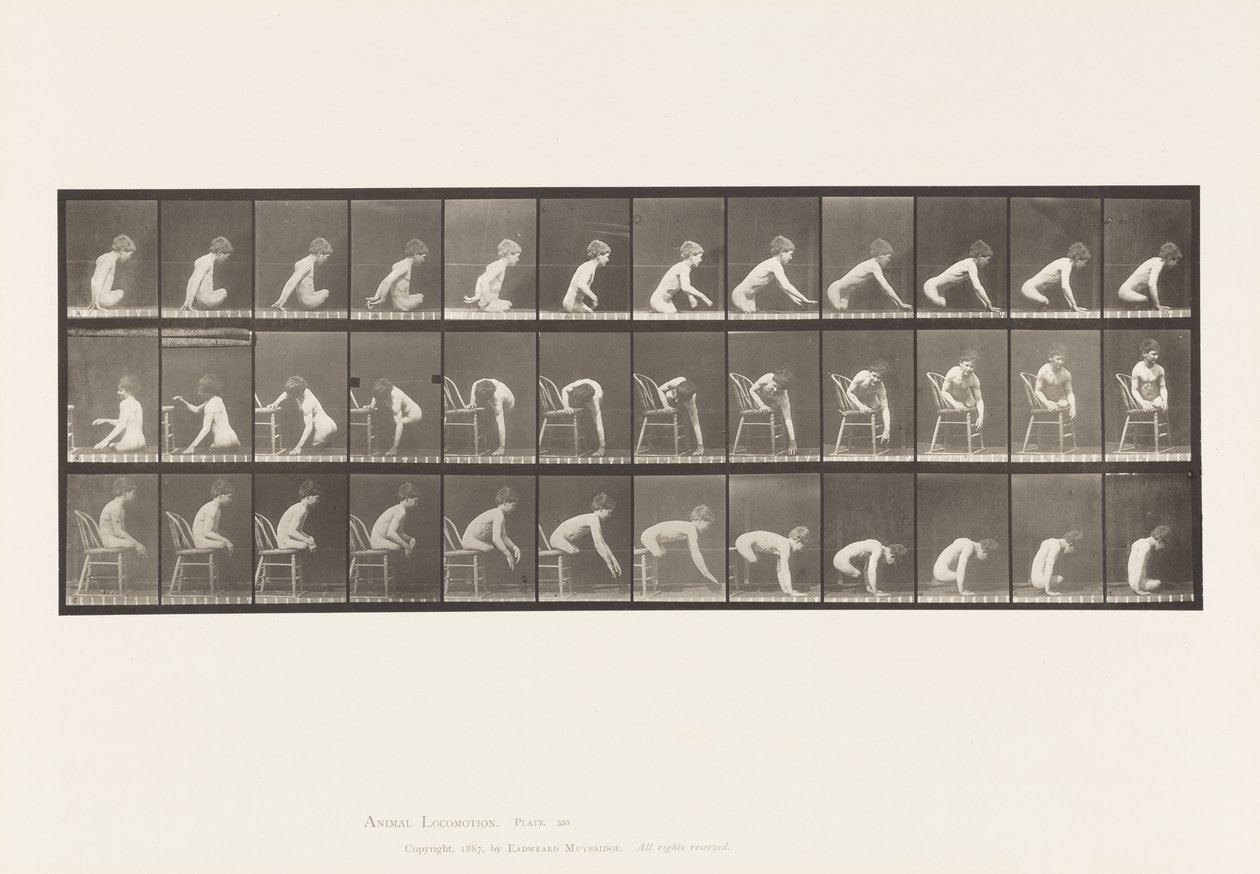 Plåt 538. Dubbel amputation av lår; Pojke; A, gå framåt av Eadweard Muybridge
