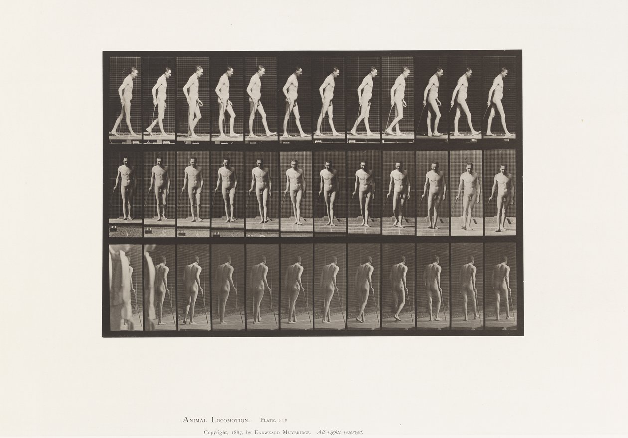 Platta 559. Disseminerad skleros; Går med Cane av Eadweard Muybridge