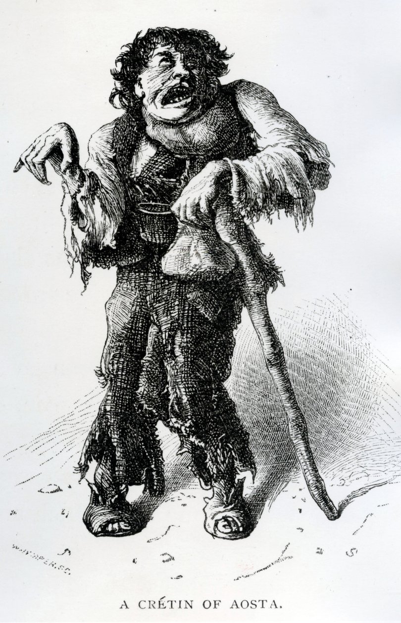 A Crétin of Aosta, c.1870 (trästick) av Edward Whymper