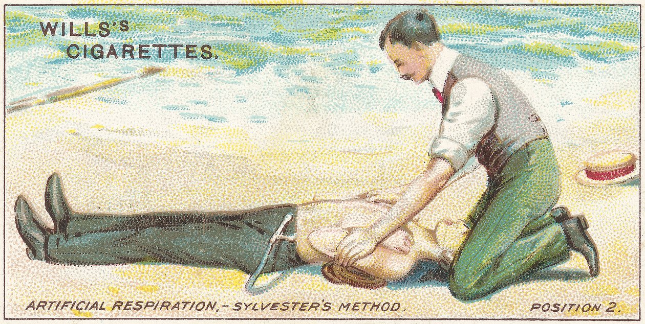 Artificiell andning, Sylvester
