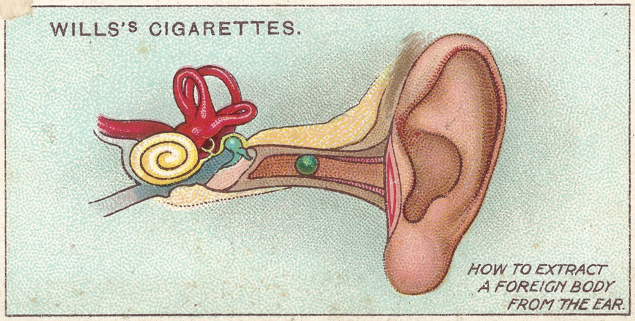 Främmande kropp i örat, nr. 30 från First Aid-serien av Willss cigarettkort, 1913 av English School
