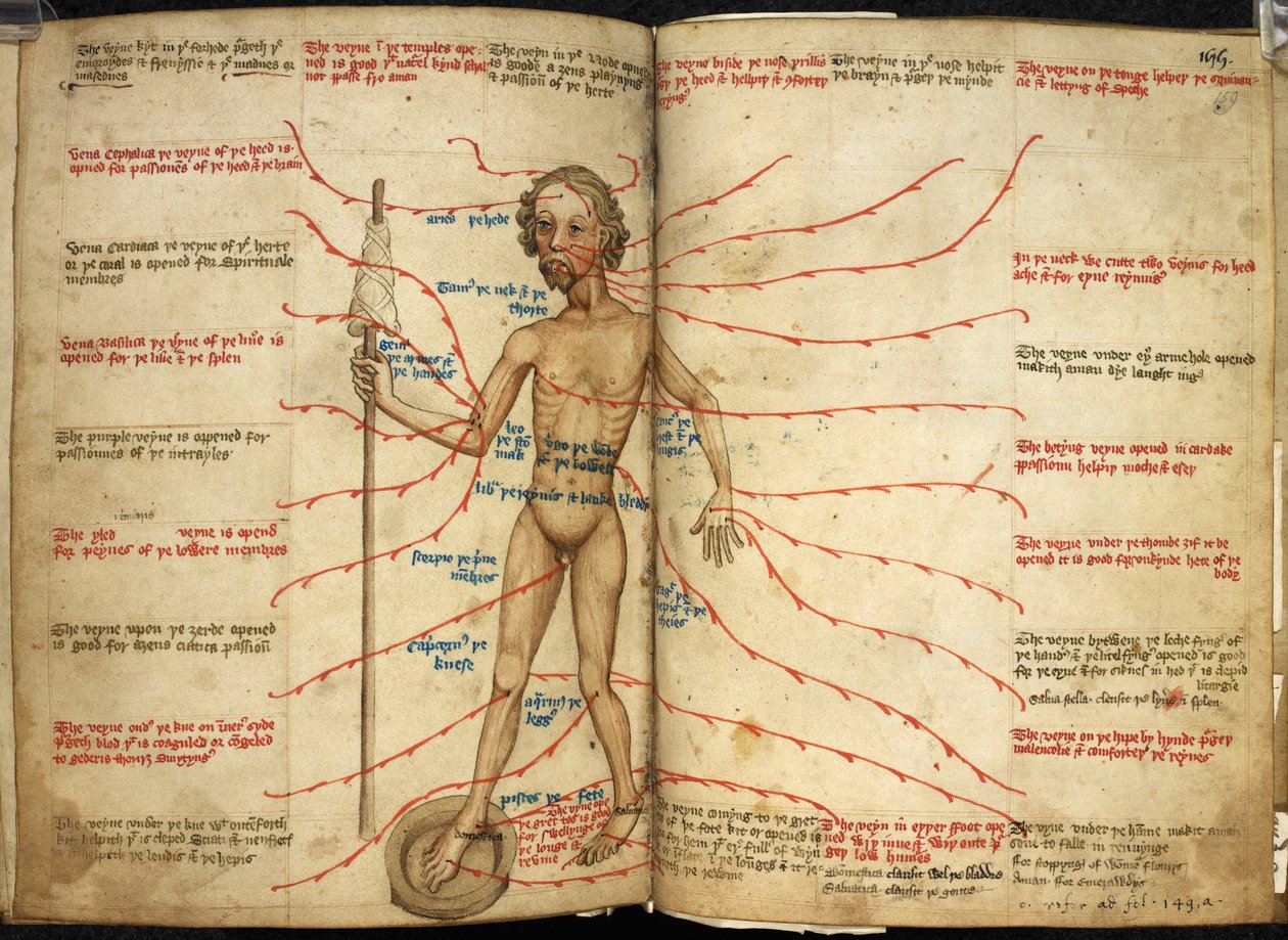 Harley 3719, ff.158v-159 Miniatyr av en blodbadande man med en fot i en blödande panna och en spindel i handen, illustration från 