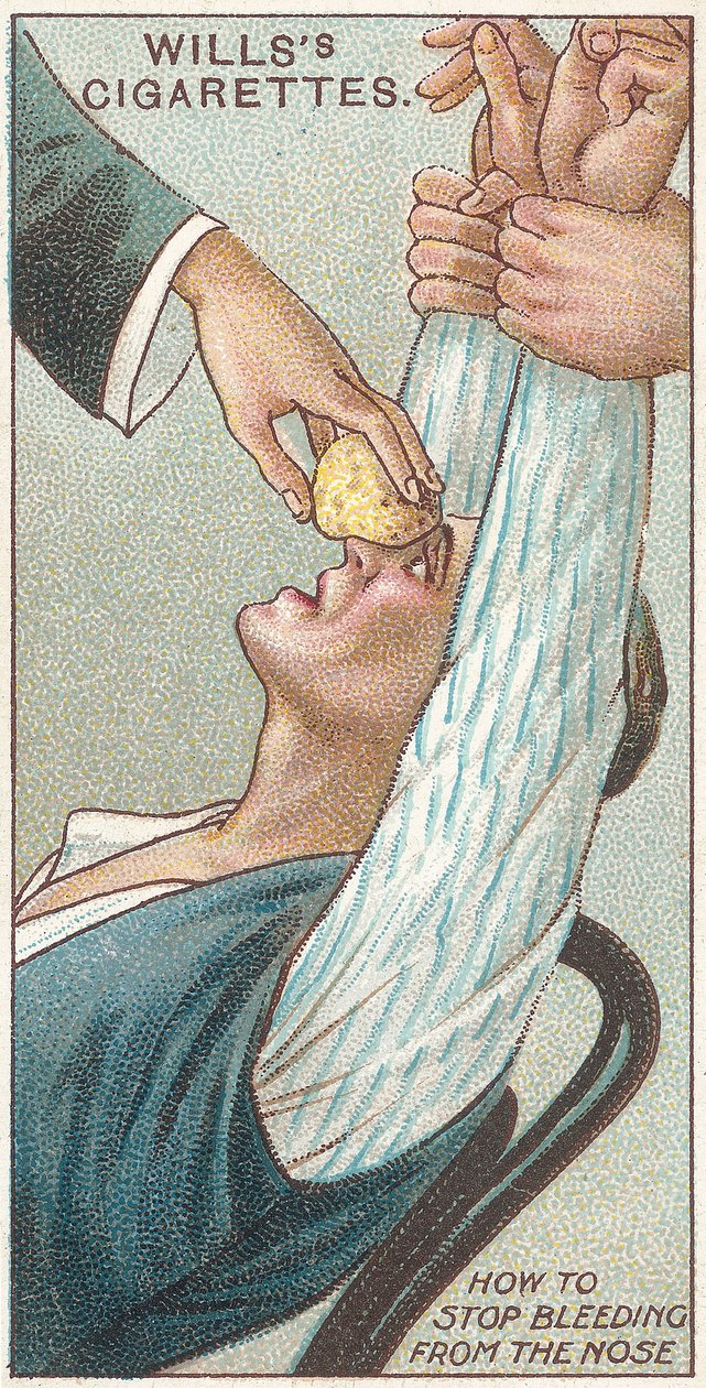 How to Stop Bleeding from the Nose, nr 31 från First Aid-serien med Willss Cigarettes-kort, 1913 av English School