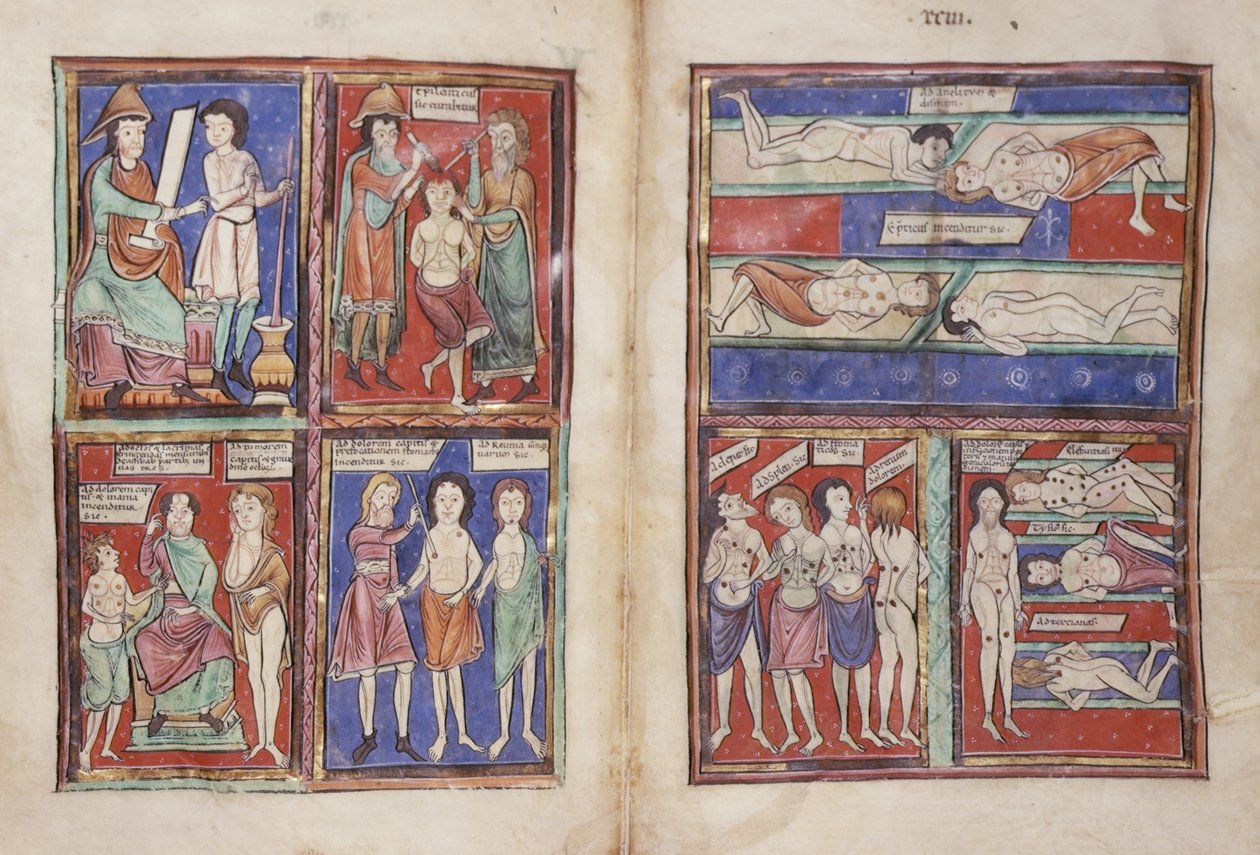 Sloane 1975 fol.91v-92 Medicinska scener av English School