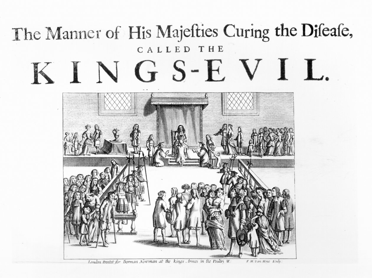The Way of his Majesty Curing the Disease Called the King