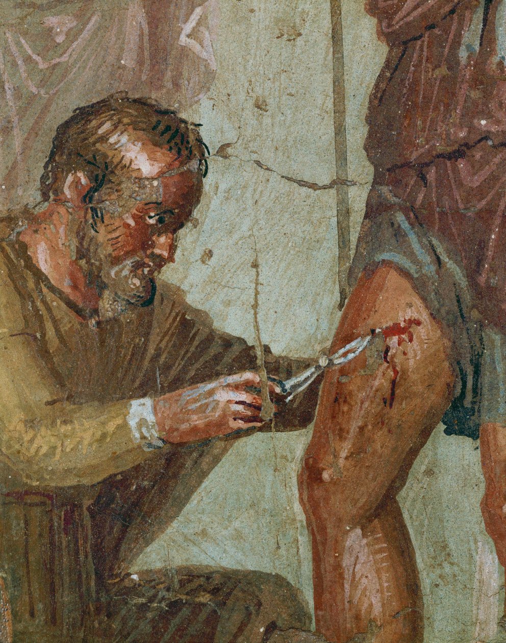 Den sårade Aeneas mellan Venus och Ascanius (fresk) av Erich Lessing