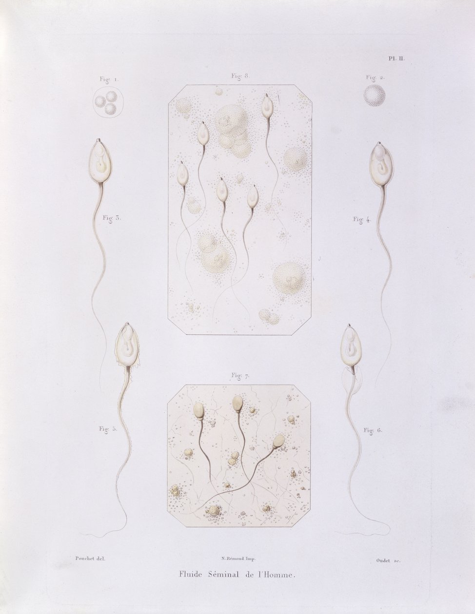 Seminalvätska, från Theorie Positive de lOvulation Spontanee et de la Fecondation des Mammiferes et de lEspece Humaine av Felix-Archimede Pouchet (1800-72) graverad av Oudet, Paris, 1847 (färgad eng. av Felix Archimede Pouchet