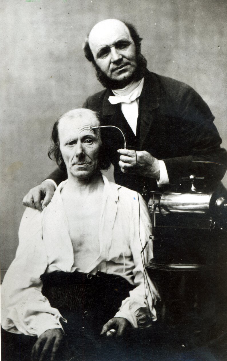 Duchenne de Boulogne med en offerpatient, 1862 av French Photographer