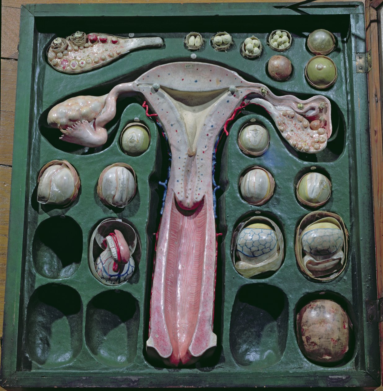 Kvinnliga könsorgan, c. 1830 (målad kartong) av French School