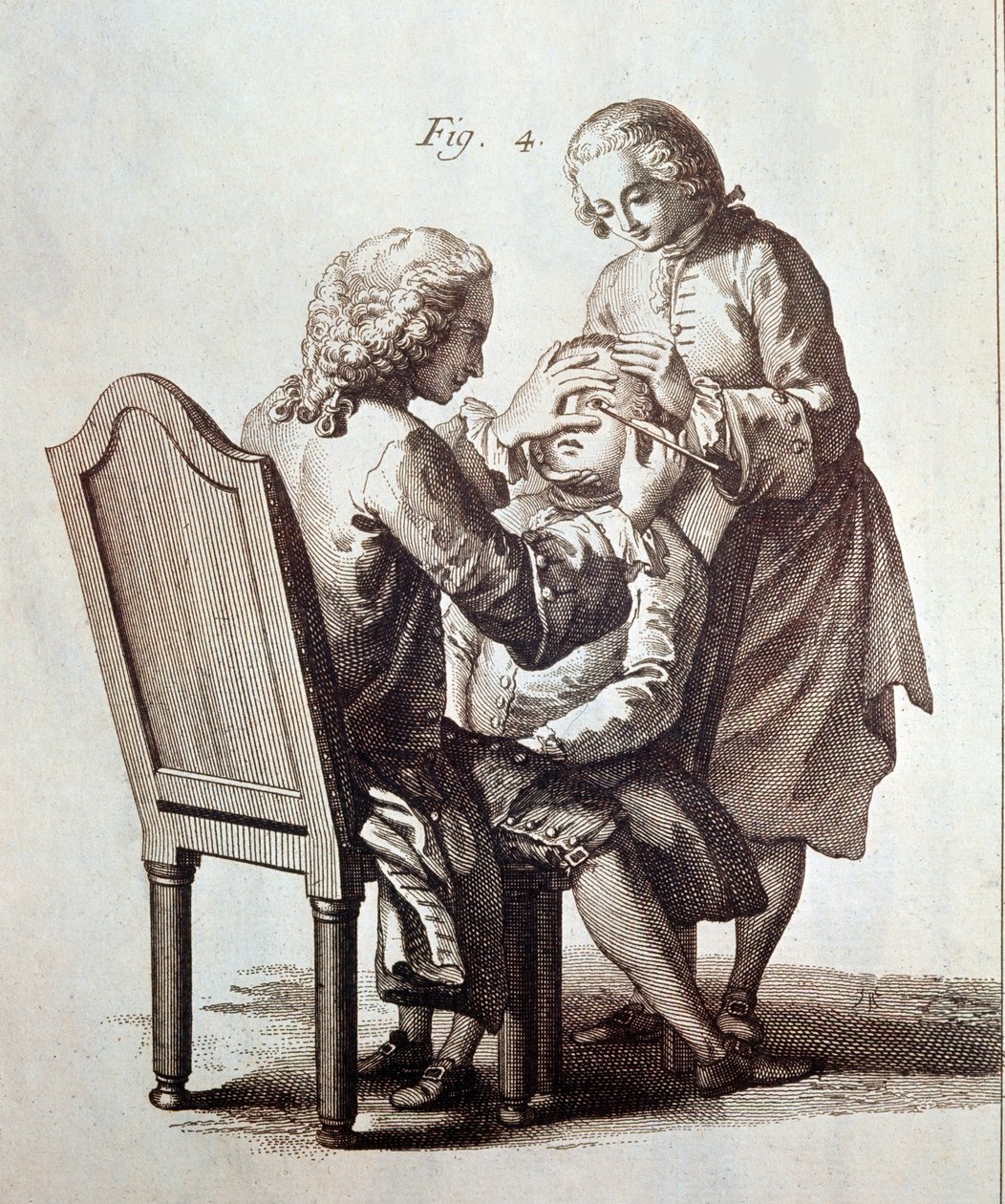 En läkare som opererar en patient med grå starr, illustration från Medical Encyclopedia av Denis Diderot och Jean le Rond d