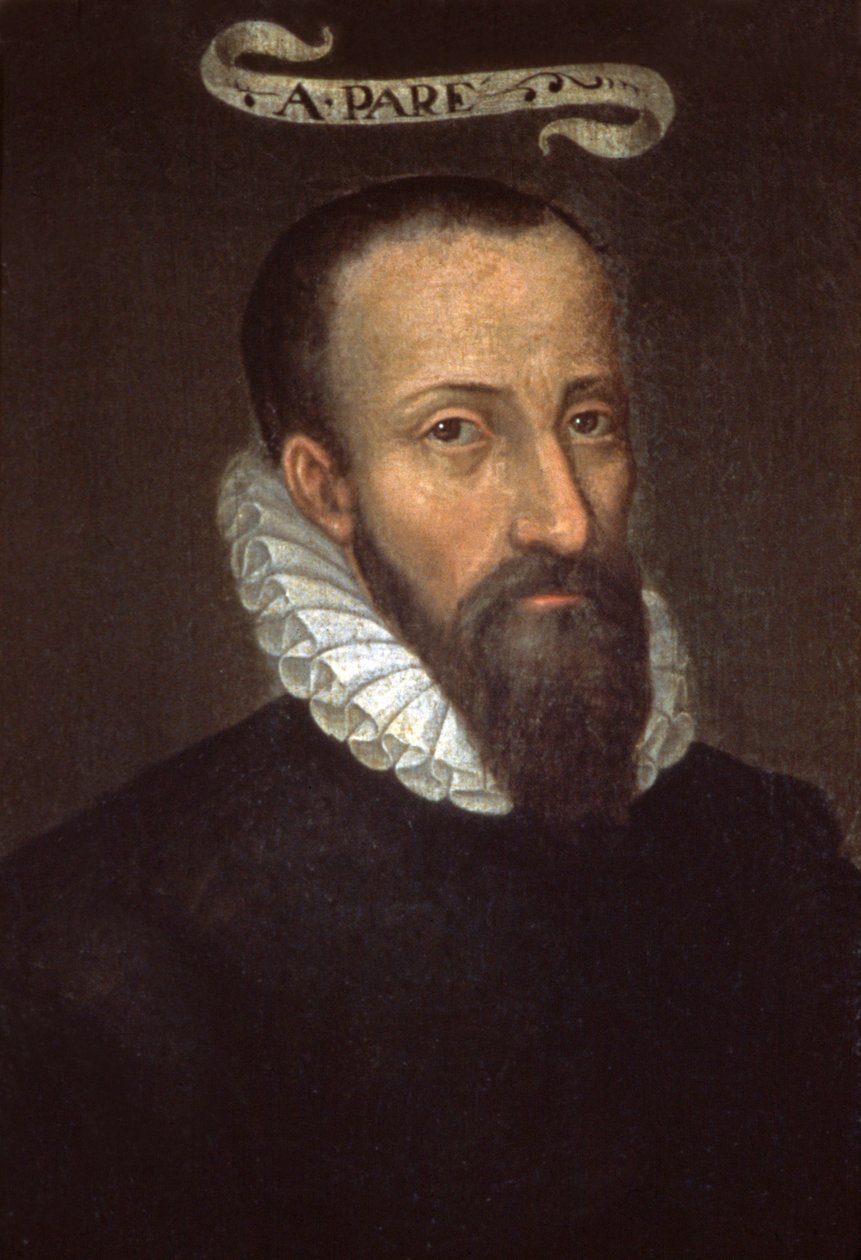 Ambroise Pare. 1500-talet (målning) av French School