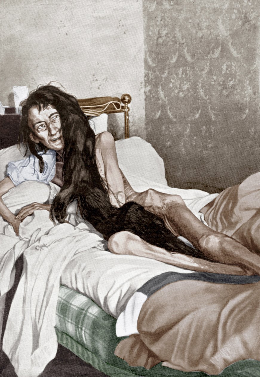 Blanche Monnier på sjukhus, Poitiers, juni 1901 (tryck) av French School