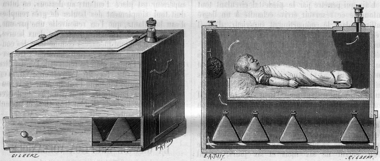 Barnkuvös av Dr Alfred Auvard (1855-1940), enligt den apparat som används på förlossningsavdelningen, till vänster, utvändigt, till höger inifrån. i "La Nature. Revue des sciences et de ses applications aux arts et à l