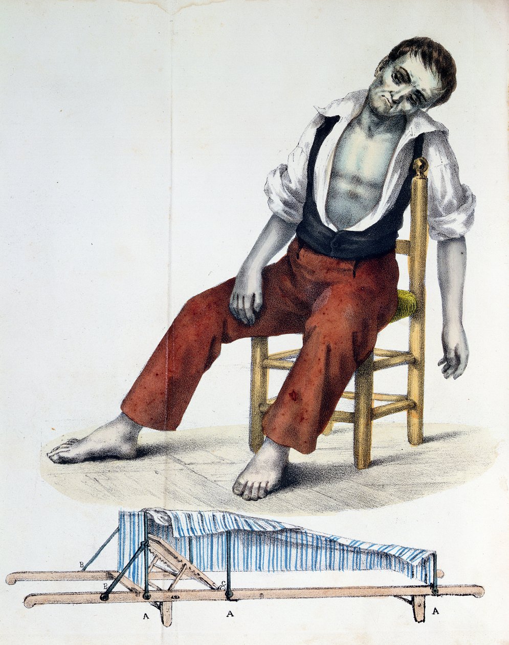Cholera Morbus, från Relation, History, Statistics and Medicine of Cholera-Morbus av Francisco dAssis de Souza Vaz, 1833 av French School