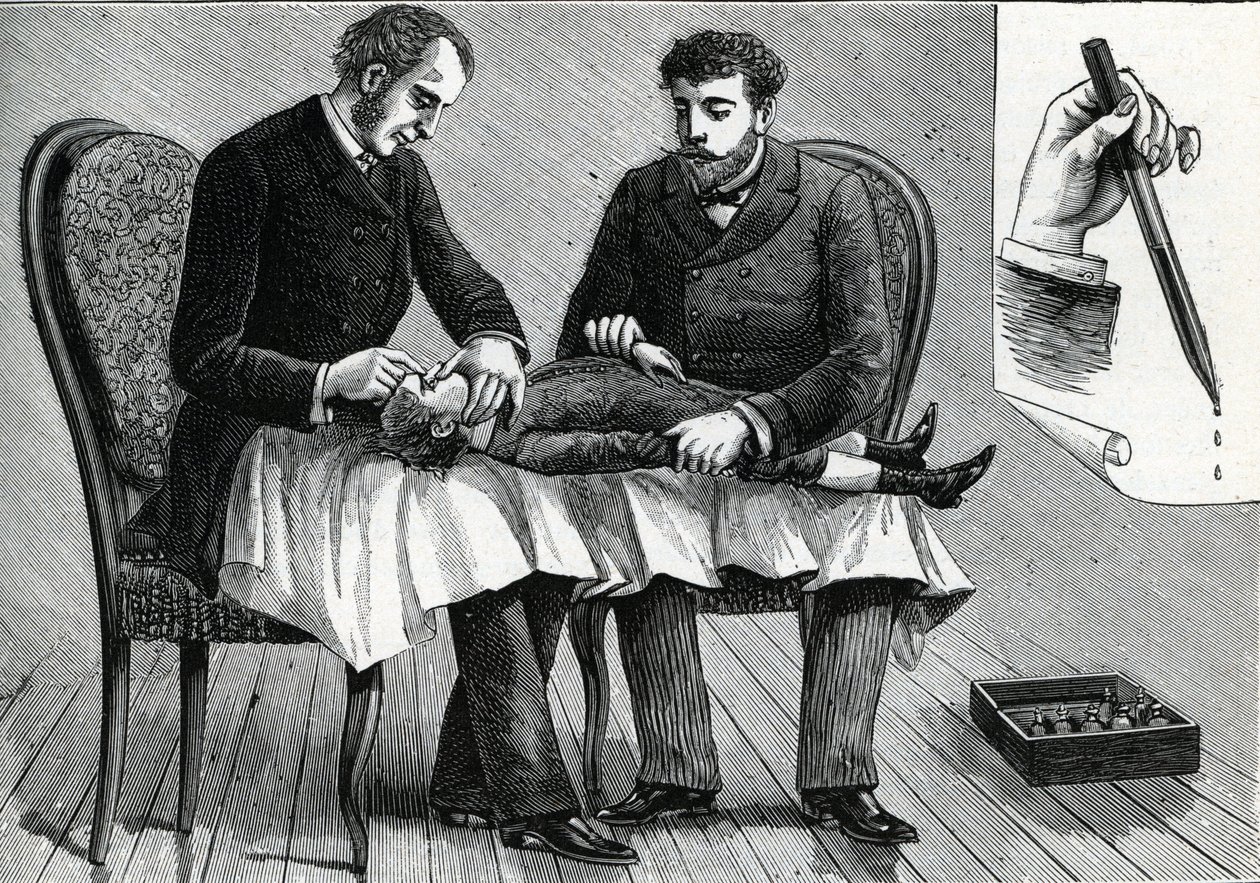 Läkare som undersöker ett barns ögon och injicerar ögondroppar (gravyr) 1888 av French School