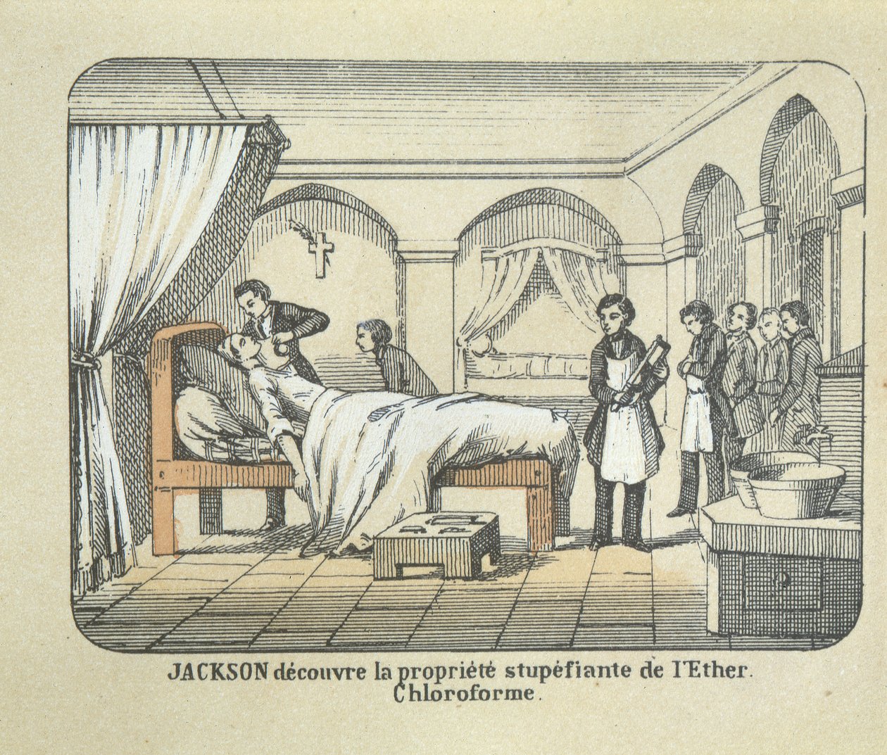 Dr Charles Jackson (1805-80) upptäcker eterns bedövningsegenskaper av French School
