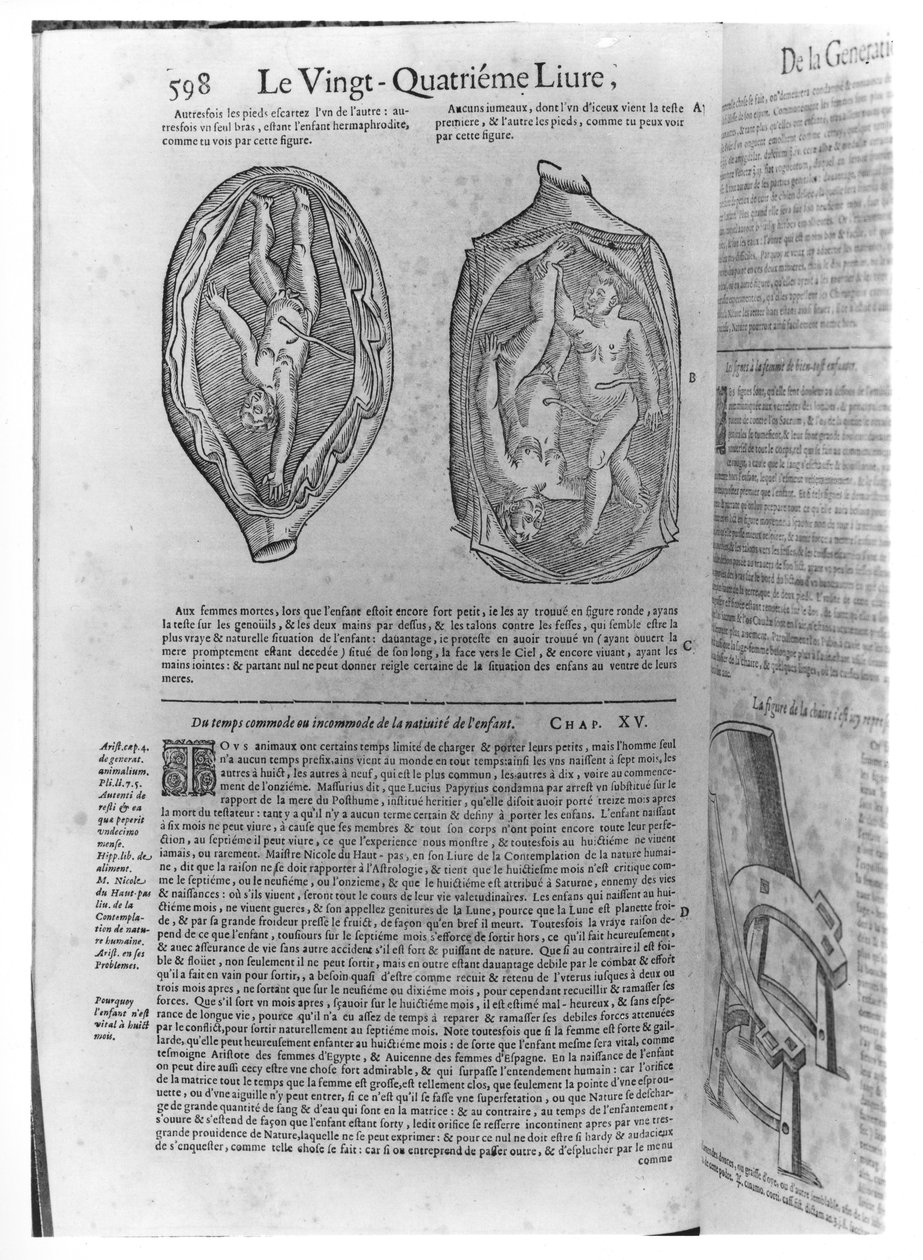 Foster, illustration från Oeuvres av Ambroise Pare (1509-90) publicerad i Lyon, 1641 av French School